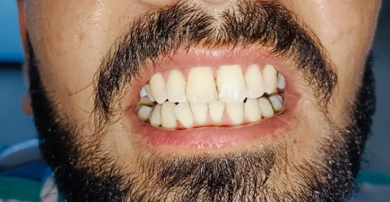 Dental After